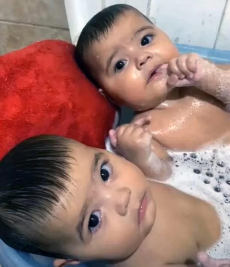 Incêndio fatal em casa no Rio de Janeiro causa morte de gêmeos