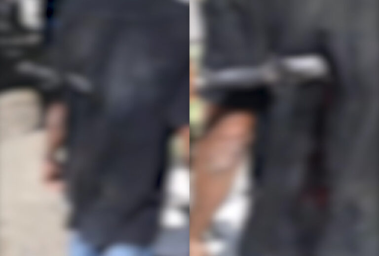 Homem é visto com faca cravada nas costas