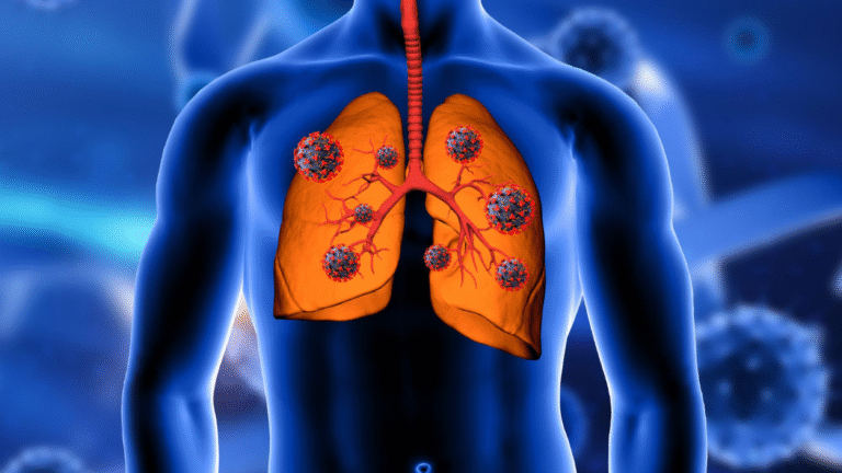Doenças que afetam os pulmões: conheça 6 condições e suas diferenças