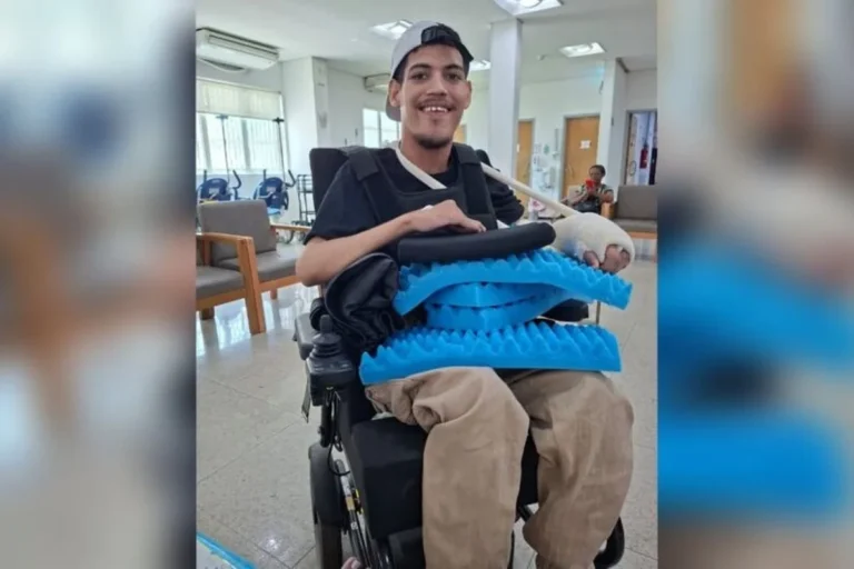 Cirurgia restabelece funções do braço de jovem com Síndrome de ZZTK