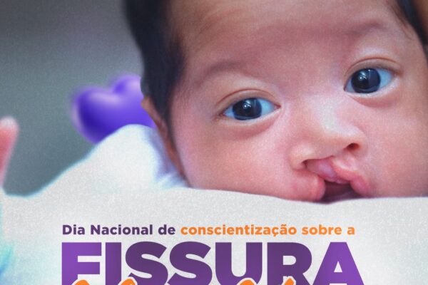 Dia Nacional de Conscientização sobre a Fissura Labiopalatina é comemorado no HUOP com Festa Junina