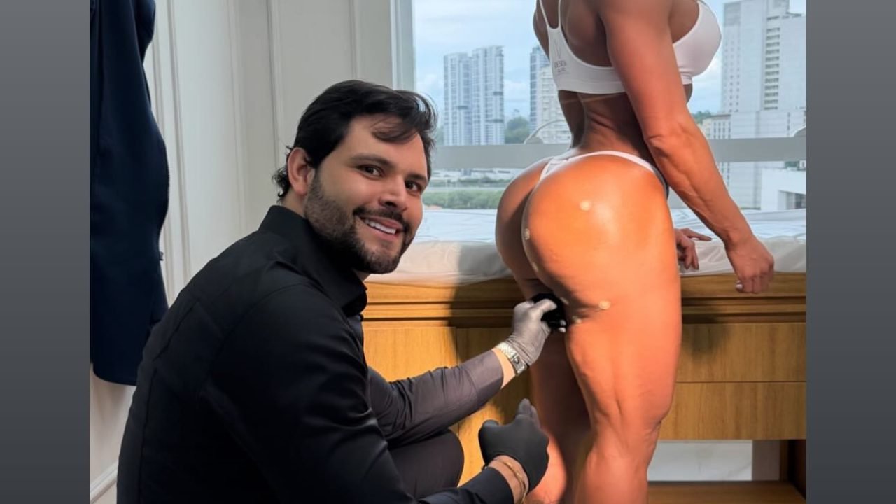 Musa fitness e ex-BBB, Gracyanne Barbosa passa por harmonização no bumbum; veja resultado