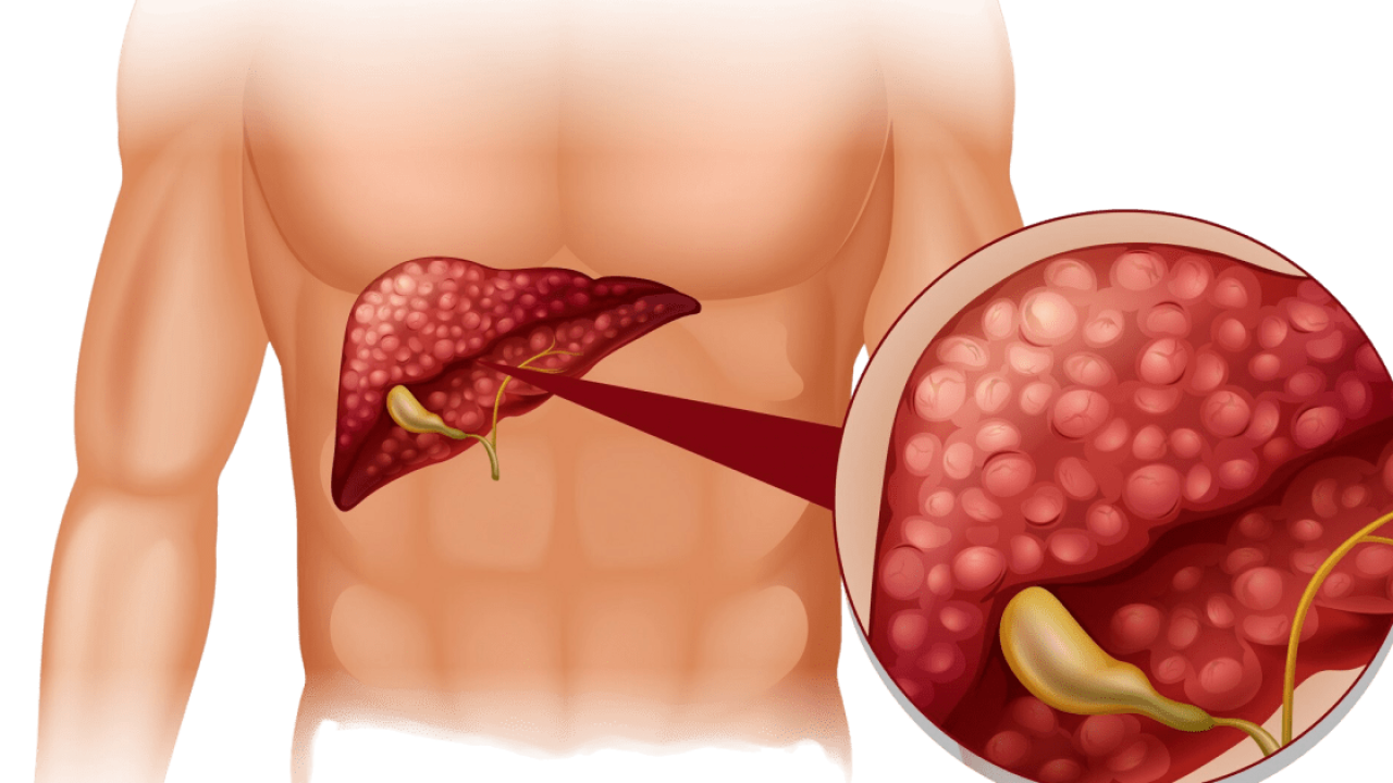 diagrama-da-esclerose-em-humanos