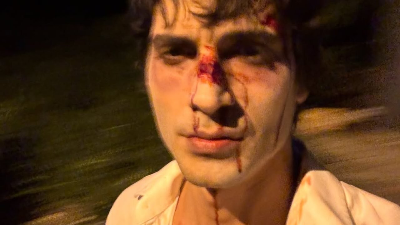 Fiuk posta foto assustadora e choca web; veja